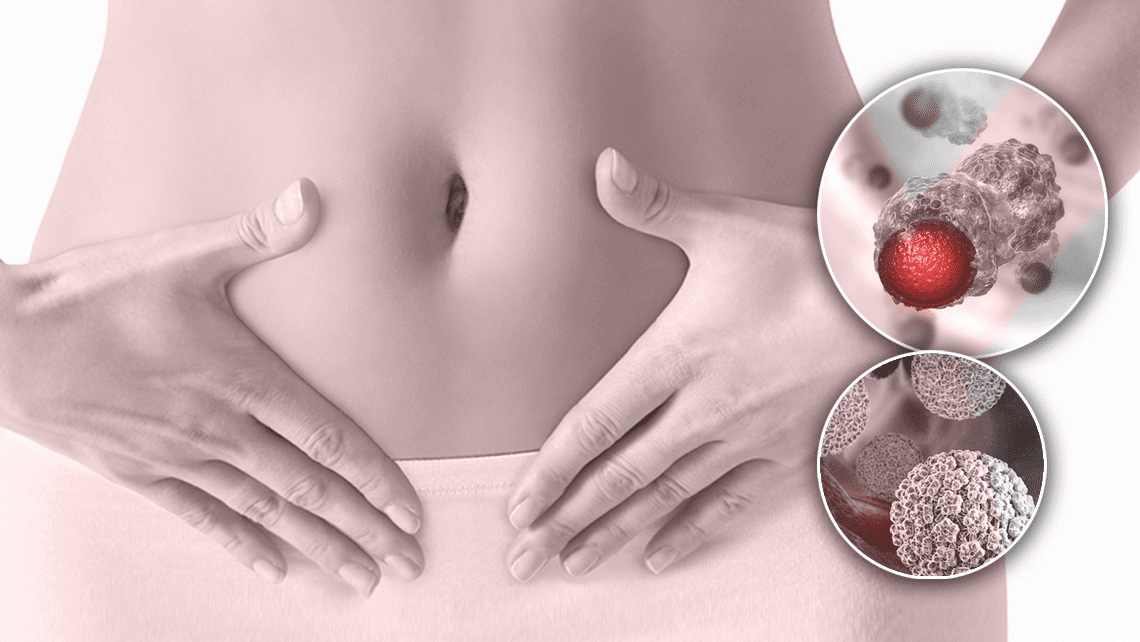 Hình ảnh minh họa phụ nữ chạm tay vào vùng bụng dưới, kèm hình mô phỏng tế bào HPV và tổn thương cổ tử cung – biểu thị nguy cơ ung thư cổ tử cung và tầm quan trọng của HPV test, Pap test trong tầm soát cho phụ nữ trên 30 tuổi.