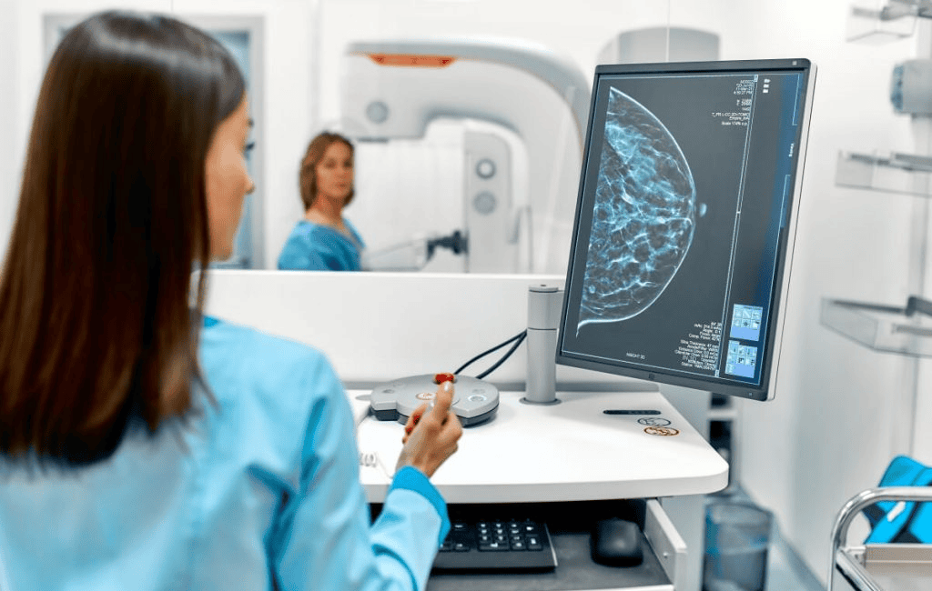 Chụp nhũ ảnh Mammography giúp chẩn đoán u vú
