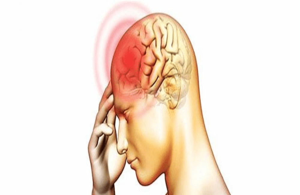 Bệnh não mô cầu có thể gây đau đầu và sốt
